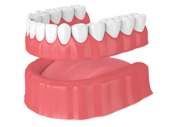 Conventional Denture in Chattanooga, TN, at St. Elmo Dental